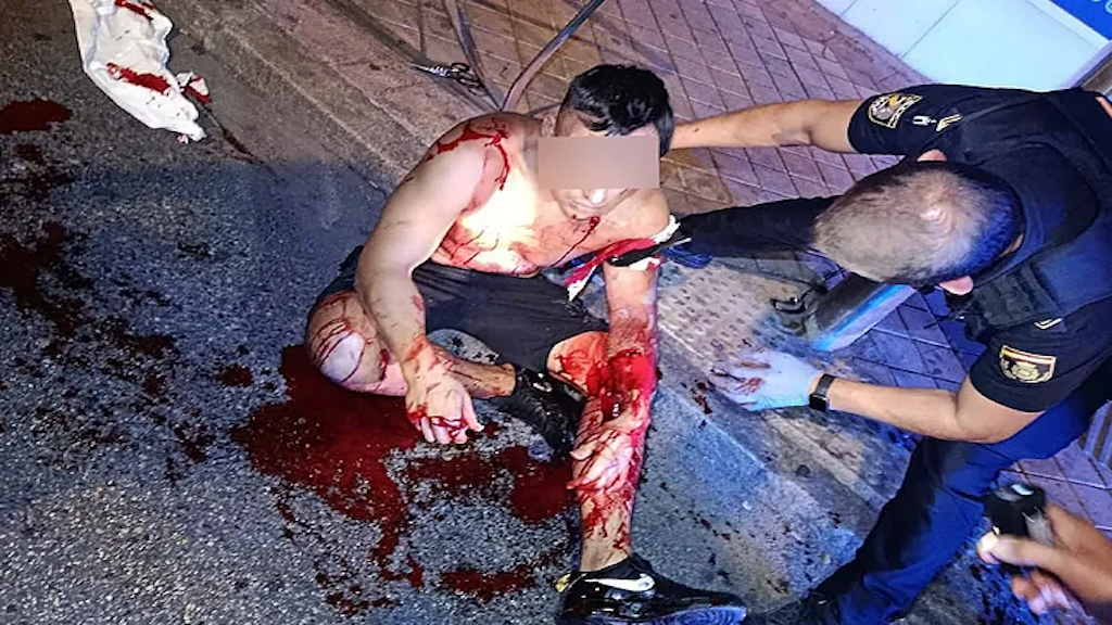 herido sangrando por arma blanca